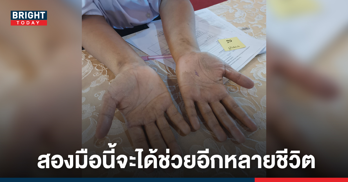 สุดซึ้ง! ครูถามสาเหตุนร. สอบสัมภาษณ์ มือดำลอก พอรู้ถึงกับอึ้ง ขอบคุณที่เลือกเรียนพยาบาล