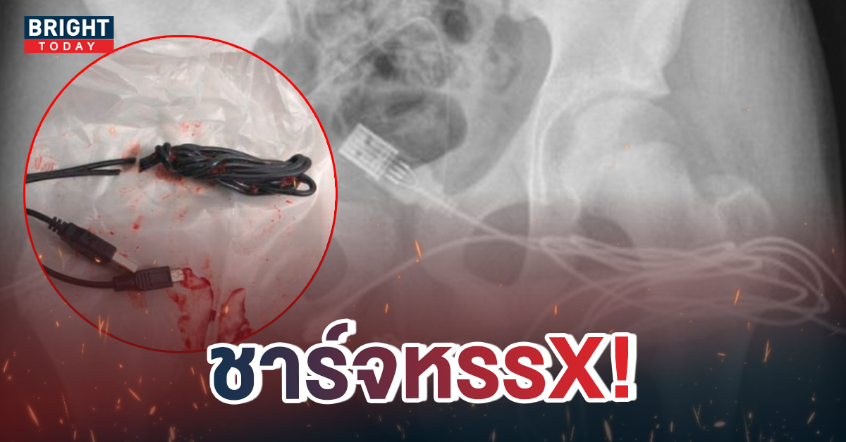 ยัดสาย-USB-เข้าเจ้าโลก