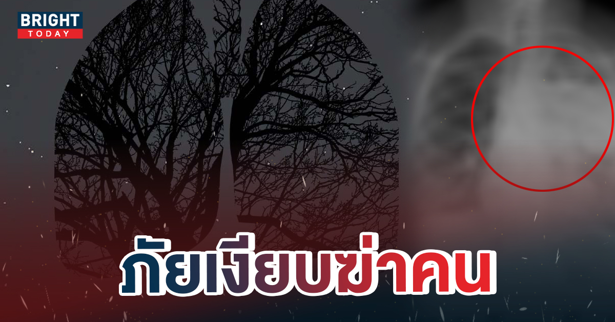 PMฝุ่นมะเร็งปอด