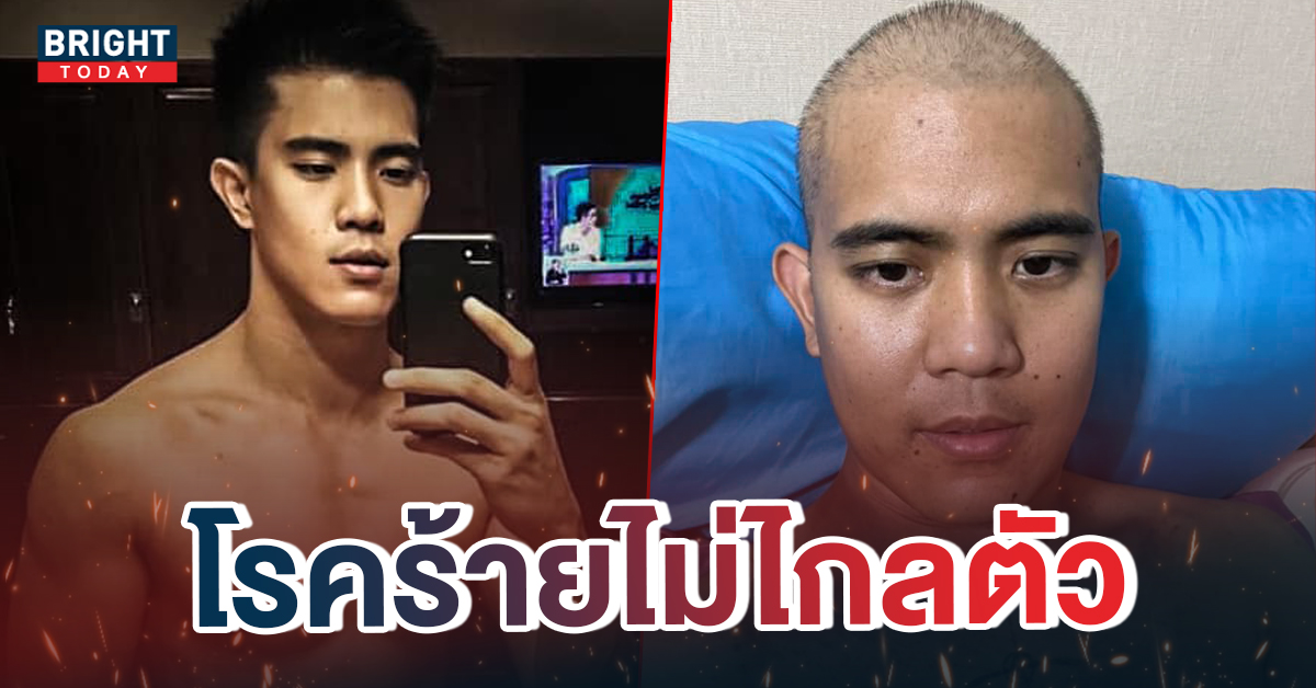 ตำรวจหล่อ แชร์ประสบการณ์ ป่วยหนักระยะลุกลาม แต่งานนี้ทำเอาชาวเน็ตโฟกัสผิดจุด