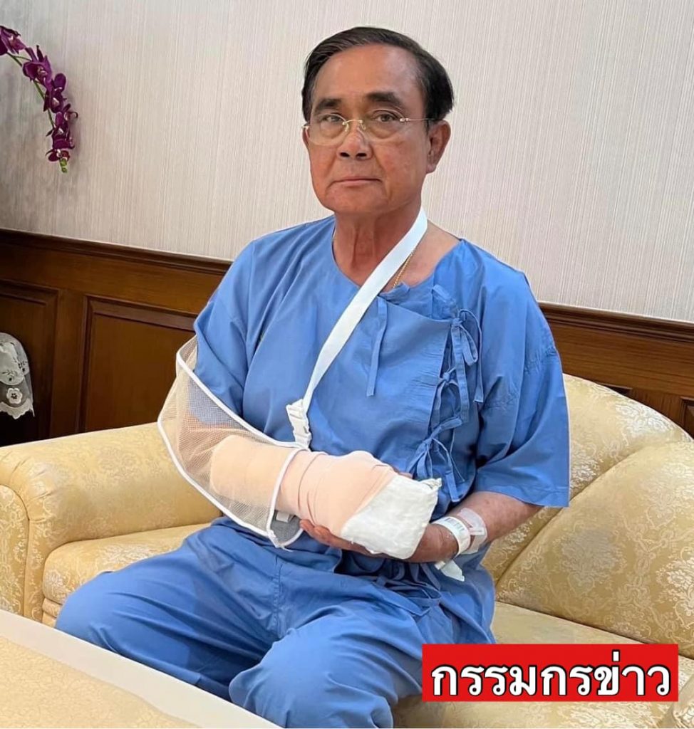 -นายกมือบวม-หวยไทย-16-3-66-หวยประยุทธ์