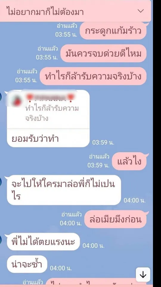 กระดูกแก้มร้าว