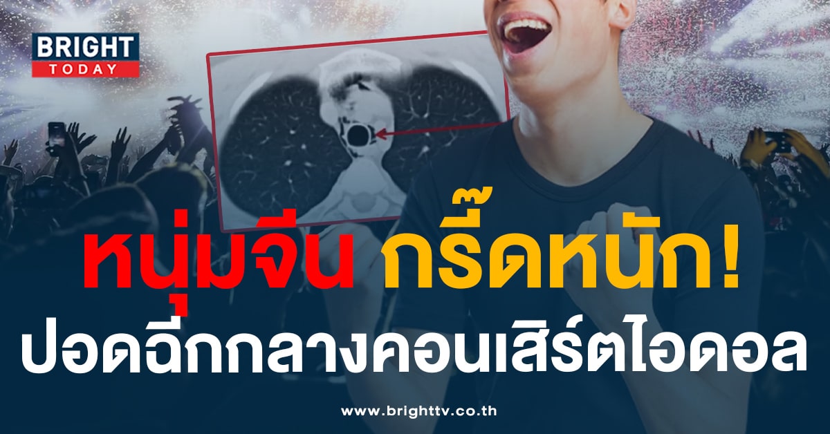 ศิลปินอึ้ง! แฟนบอยชาวจีน ส่งเสียงกรี๊ดสนั่น กลางคอนเสิร์ต จนปอดทะลุ