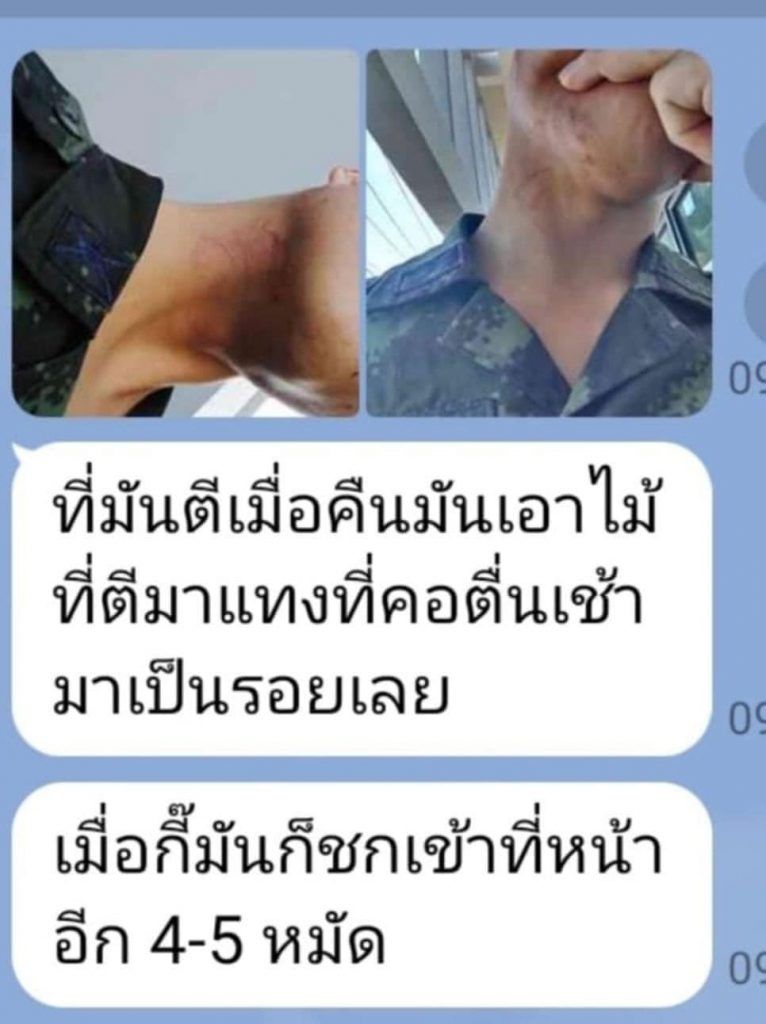 จ่ากองร้อยทำร้าย3-min