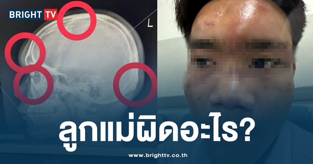 แม่ใจสลาย! ลูกโดนรุ่นพี่รุมทำร้าย 10 กว่าคน จนช้ำในหนัก