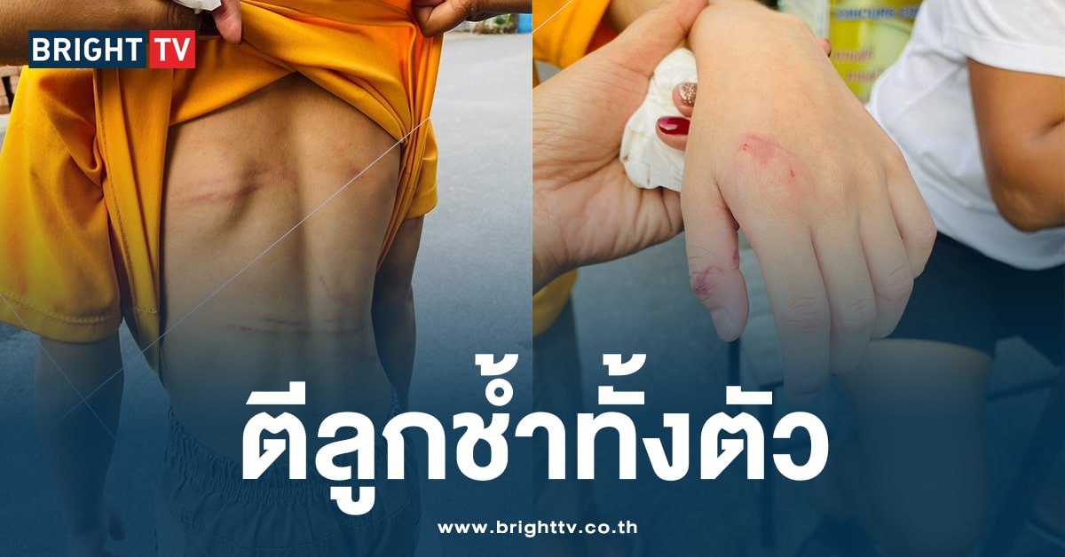 สลด! เด็ก 7 ขวบ วิ่งตามรถขยะ ร้องให้ช่วย โดนพ่อเลี้ยง-แม่แท้ ๆ ทำร้าย