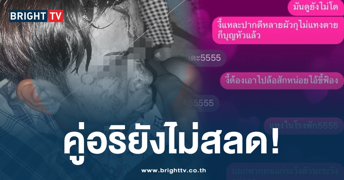 เรื่องเงียบ! ลูกชายวัย 15 ถูกอริฟันหัวเลือดอาบ แต่คนลงมือยังลอยนวล