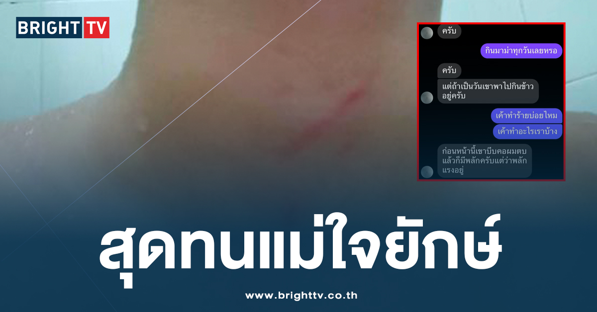 เด็กชายอายุ 13 ปี ขอความช่วยเหลือ หลังถูกแม่ทำร้ายร่างกาย ที่มาเลเซีย