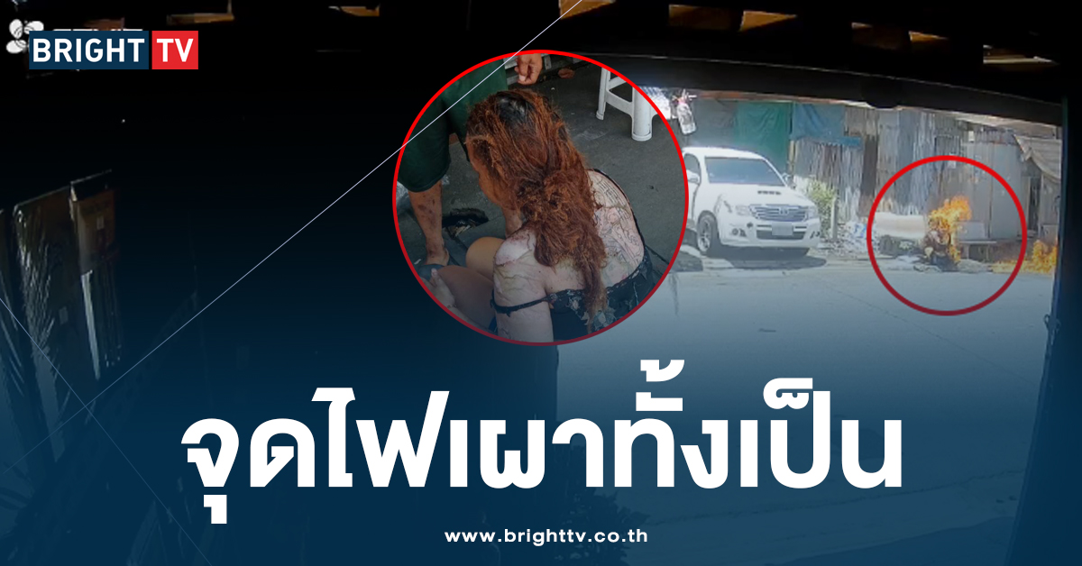 หึงโหด! แฟนหนุ่ม สาดน้ำมัน จุดไฟเผาร่าง เหตุนอกใจ-ขอเลิกไปมีคนใหม่